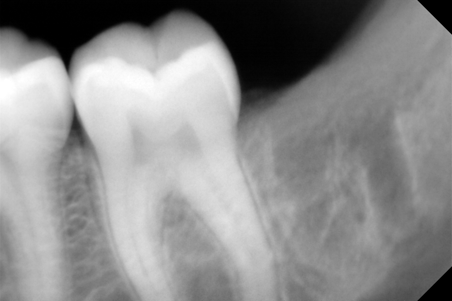 Cirurgia Oral, Dentista Entroncamento